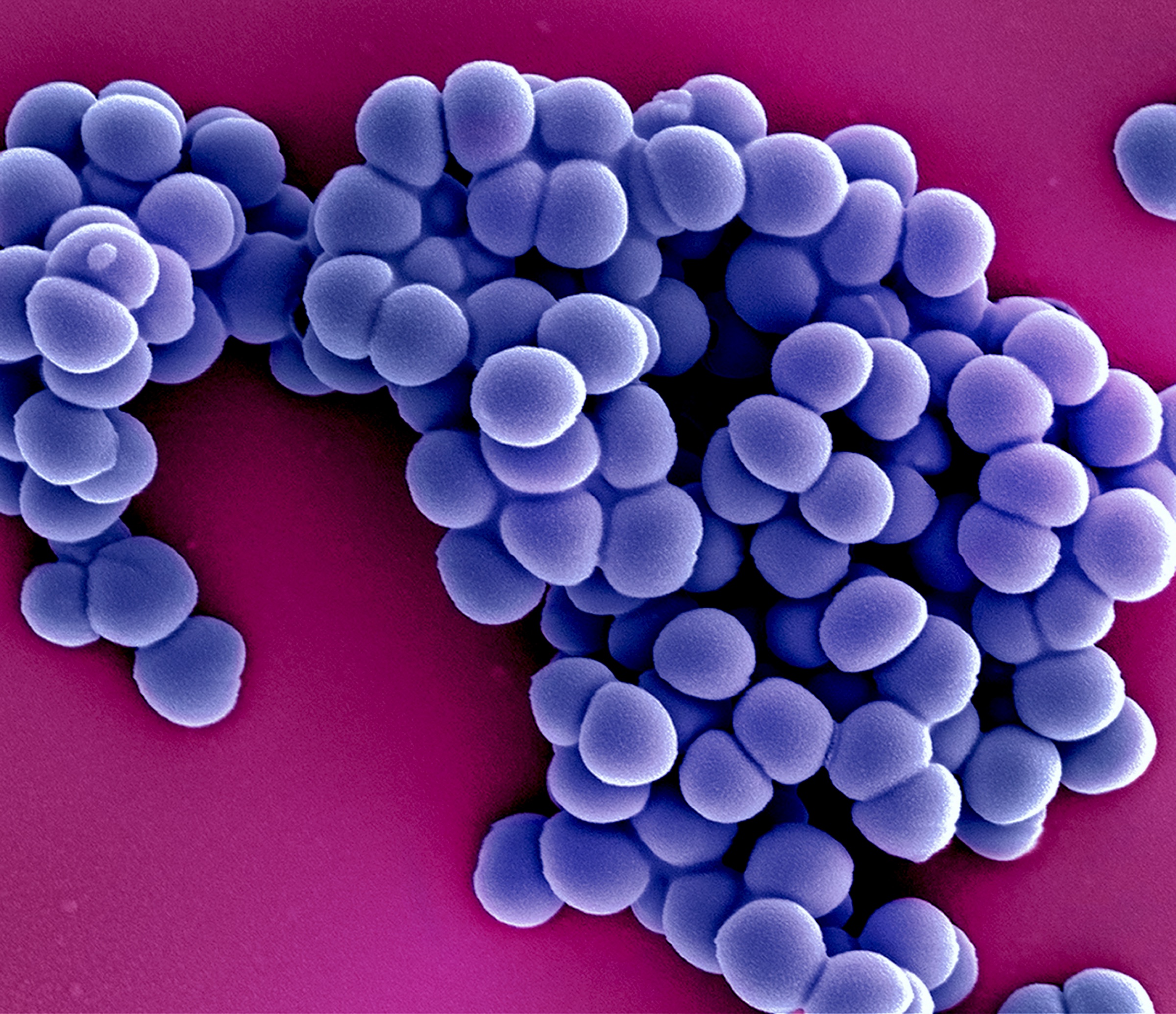 Colorized scanning electron micrograph of methicillin-resistant Staphylococcus aureus bacteria