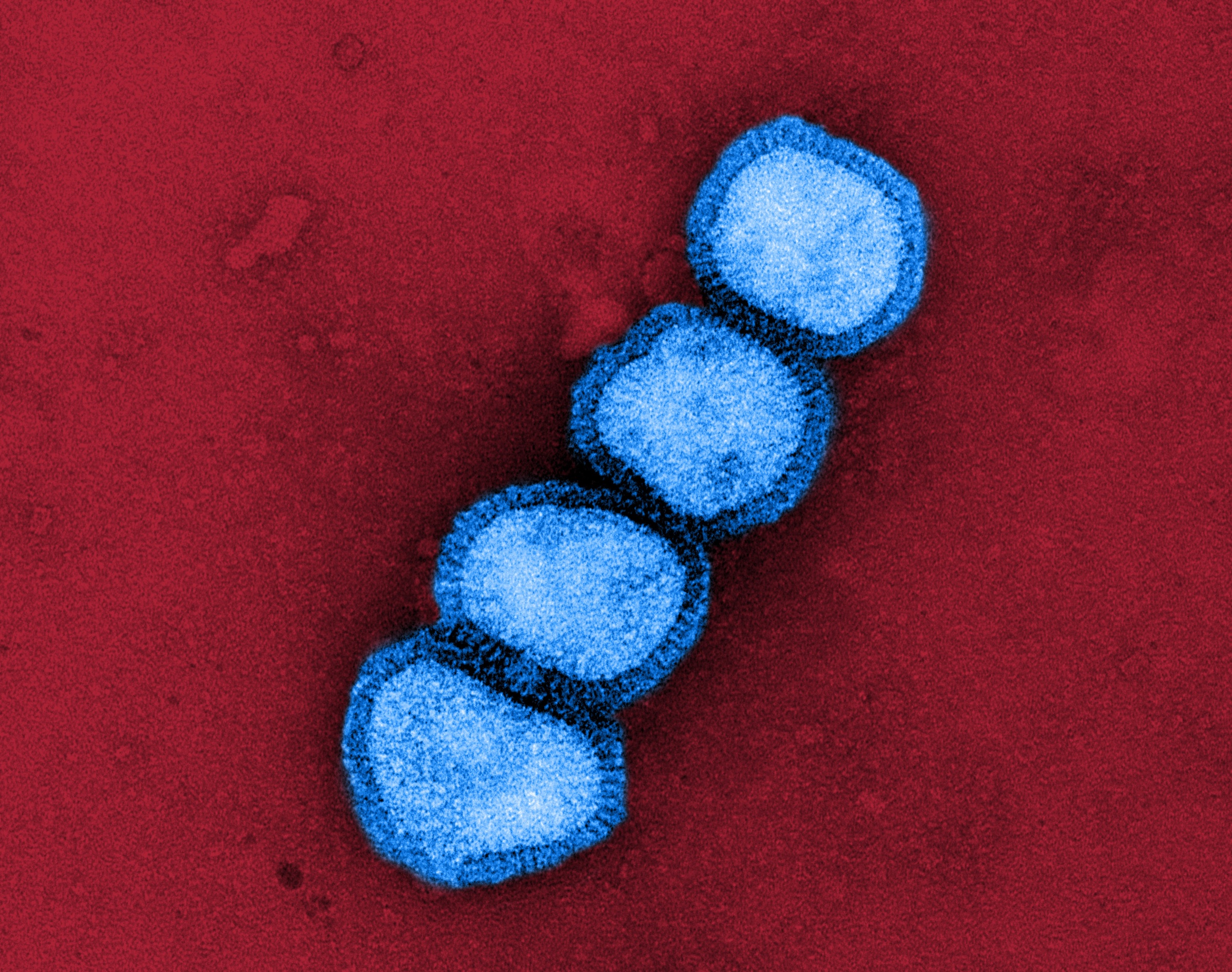 Colorized transmission electron micrograph of influenza A virus particles